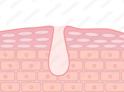 美容商材毛穴の効果効能用